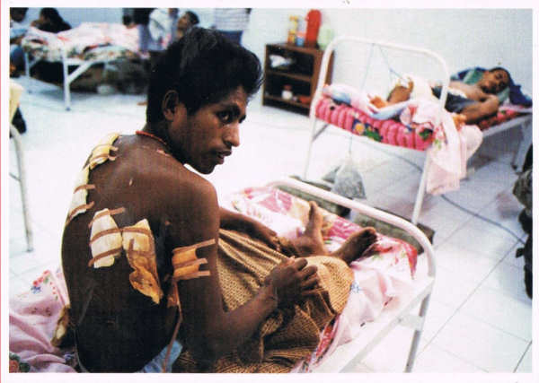 SN - Luiz Carvalho. Sobrevivente ao massacre em casa de Manuel Carrascal�o. Dili, Abril 1999 - Edi��o Arquivo Municipal de Lisboa (1999) - Dim. ???x??? mm - Col. A. Monge da Silva