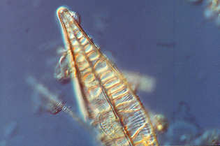4 - Pormenor da diatomácea anterior.